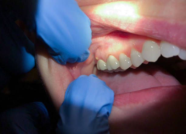 Best Emergency Gum Pain Relief  in Skyline Acres, OH