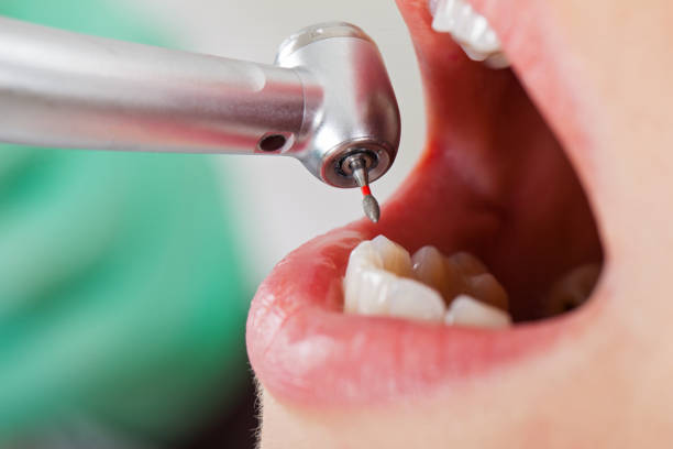 Best Cracked Tooth Emergency Dentist  in Skyline Acres, OH